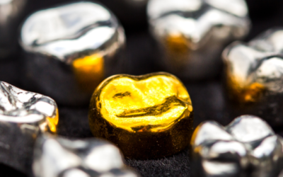 Are Gold Dental Crowns Made of Gold and Other Questions