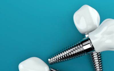 Dental Implant Surgery And The Recovery Process