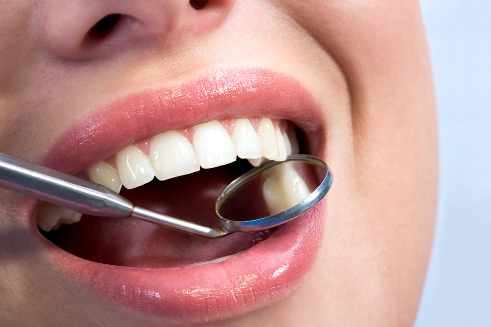 5 Dental Tips to Prevent Tooth Decay