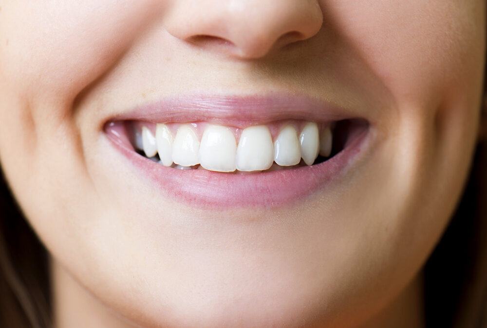 What Are Dental Caries?