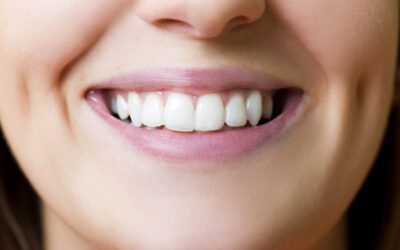 What Are Dental Caries?