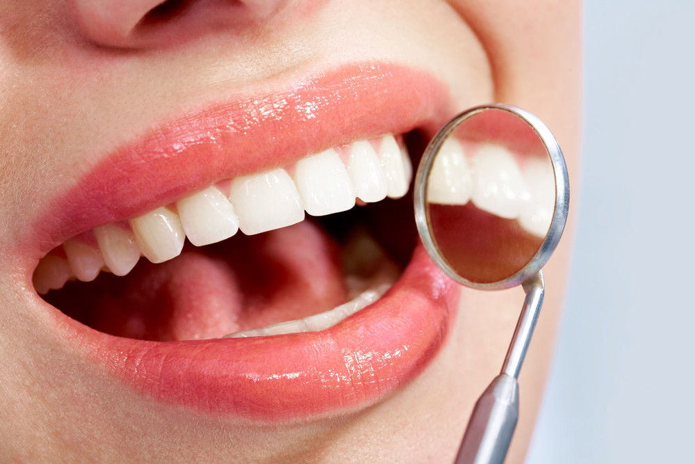 The Benefits of Professional Teeth Whitening