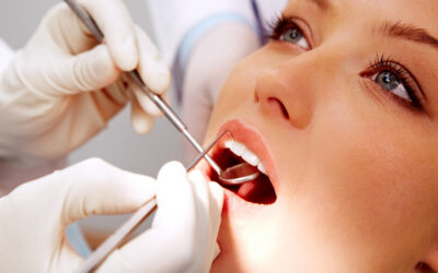 5 Signs You May Have a Cavity