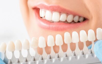 The Best Ashland Teeth Whitening Dentist for a Brighter Smile